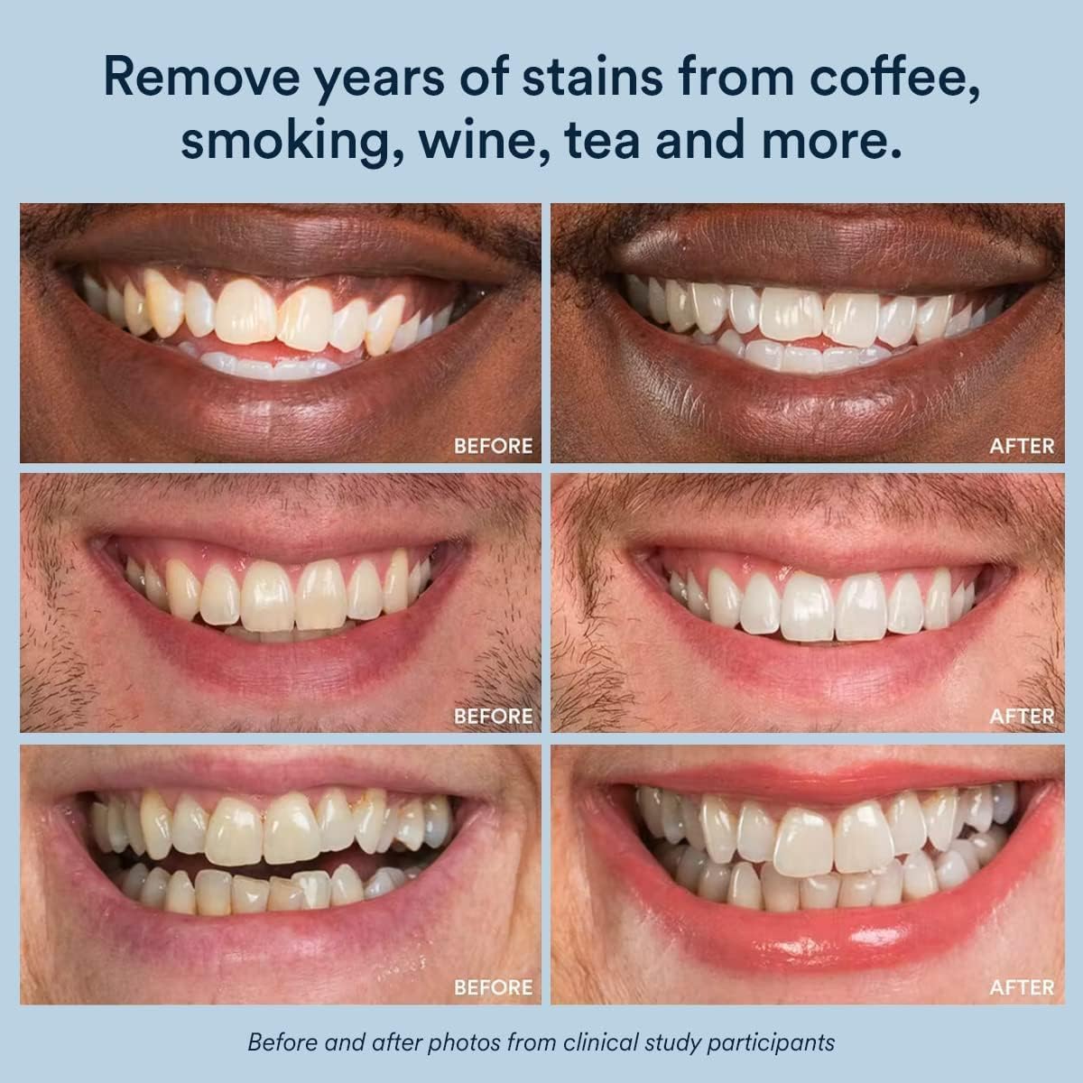 The One™ Pro-Level Whitening Pen By Arctic